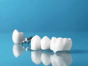 Can Dental Crowns Fix Cracked or Broken Teeth?